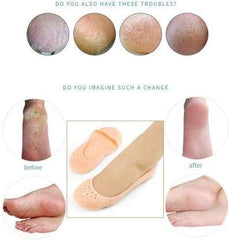 Silicone Smiling Foot Socks - waseeh.com