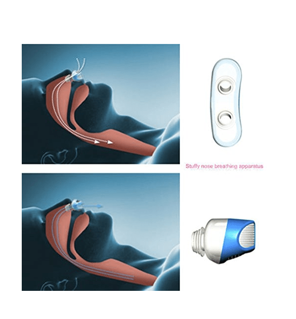 Anti-Snoring &amp; Air Purifier | Fitness | Waseeh Pakistan